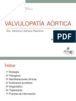 Valvulopatía Aórtica
