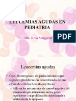 8489423 Leucemia Linfoblastica Aguda