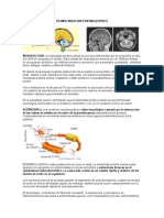 Desmielinizacion Pontina