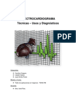 Tecnicas para Realizar Un Electrocardiograma v2