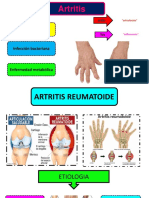 Anatomia Seminario ARTROSIS