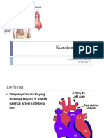 Koartasio Aorta