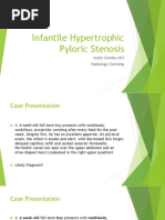 Pyloric Stenosis