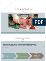 Asfixia Neonatal