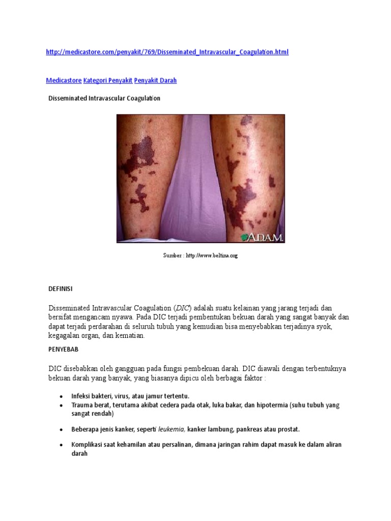 Dic 2 | PDF