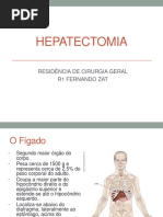 HEPATECTOMIA