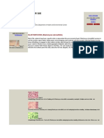 Mycology - Chapter Six Dimorphic Fungi: BLASTOMYCOSIS (Blastomyces Dermatitidis)