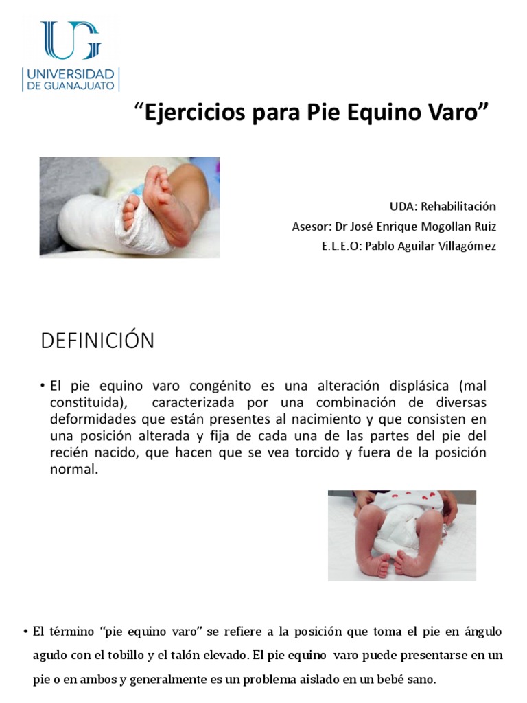 Pie Equino Varo Pie Tobillo