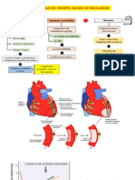 Patogenia Infarto Agudo de Miocardio