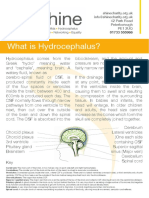 What Is Hydrocephalus