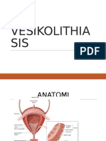 Vesicolithiasis BSH