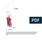 Patent Ductus Arteriosus