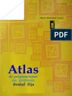 Atlas de Preparaciones en Prótesis Fija