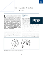 Luxación Congénita de Cadera PDF