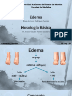 Exposición-10---Edema-(Rodríguez-Fuentes-Diego-de-Jesús).pptx