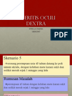 Skleritis Oculi Dextra - Blok 23