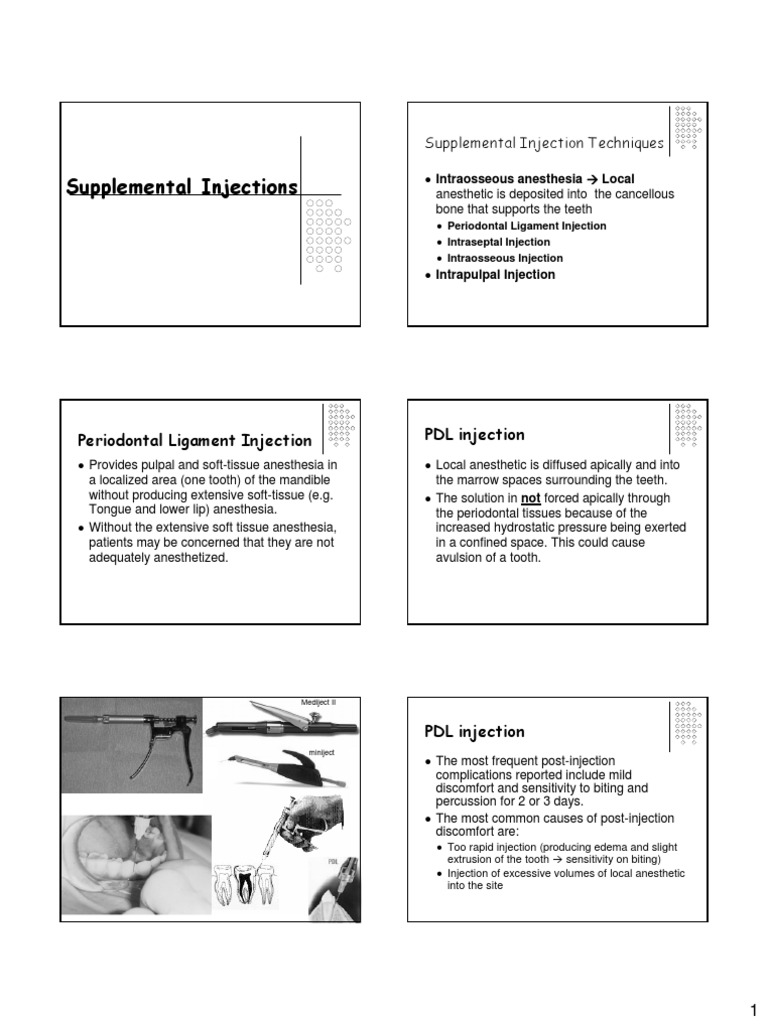 Supplemental Injections Periodontal Ligament Injection PDL Injection