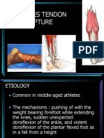 Achilles Tendon Rupture