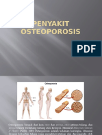 Penyakit Osteoporosis