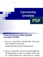 Carcinoma Urotelial Primário