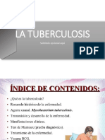 Tuberculosis