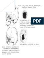 trapanaciones craneanes