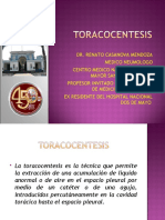 Toracocentesis Dr Casanova 100802201527 Phpapp01