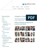 Antes y Después - Trasplante Capilar Turquía