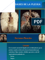 Derrame Pleural Version 1.3