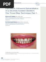 ITI Treatment Guide: Volume 1 Overview | PDF | Dental Implant