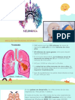 Neumonía Bacteriana