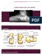 abordajes PARA FRACTURAS DE CALCANEO.pptx