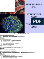 01.tuberculoza. SIDA