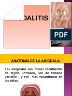 Amigdalitis Exp