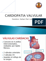 Cardiopatia Valvular
