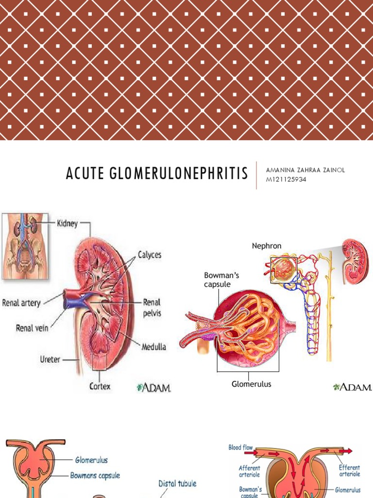 Acute Glomerulonephritis Overview | PDF | Nephrology | Medical Specialties