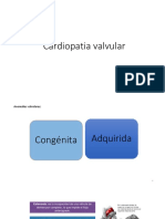 Valvulopatia