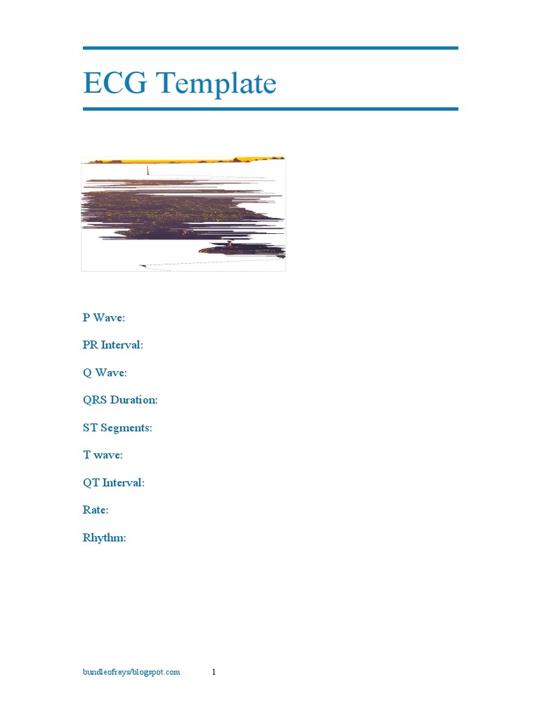 ECG Template Draft | PDF