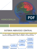 Apresentação Hidrocefalia