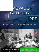 Removal of Suture