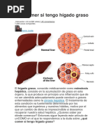 Dieta de Higado Graso