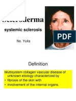 Scleroderma