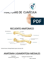 Clasificacion de Fractura de Clavicula