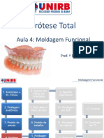 Prótese Total: Moldagem Funcional