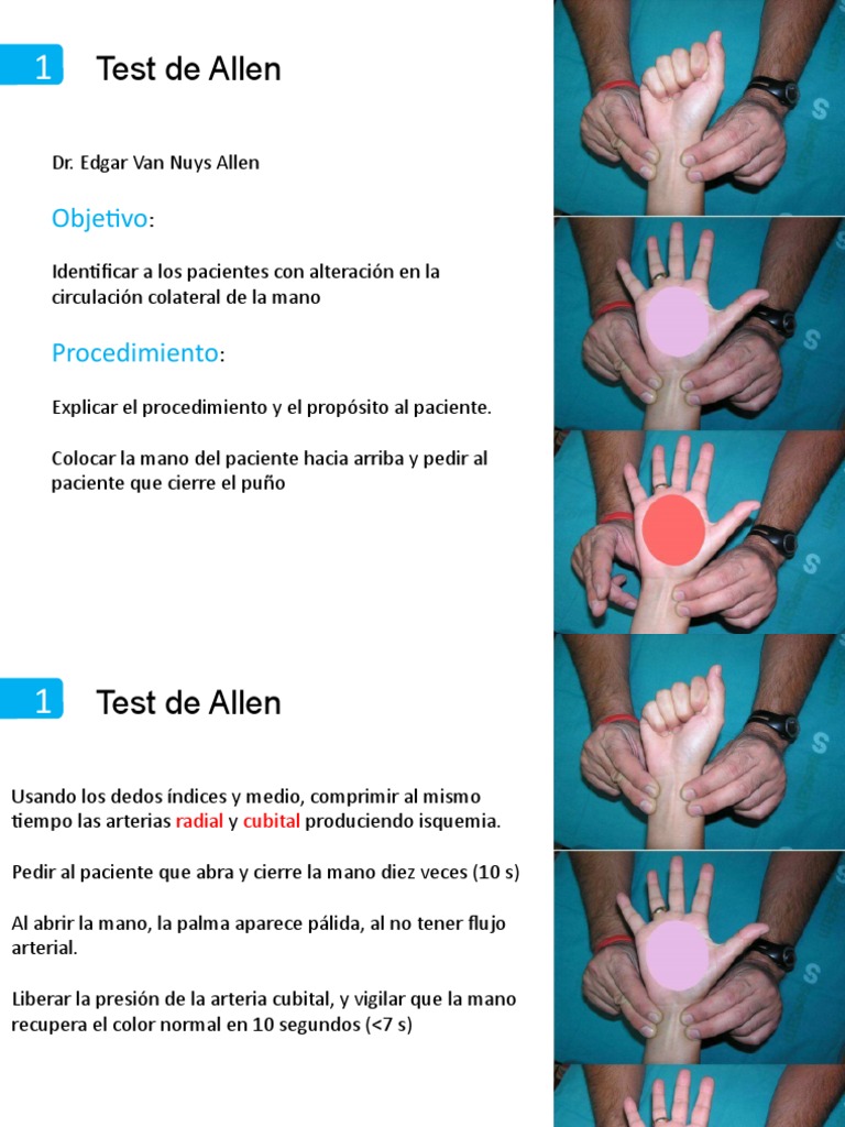 Procedimiento del Test de Allen | PDF | Ciencias de la Salud ...