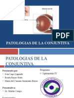 Patologias de La Conjuntiva(1)