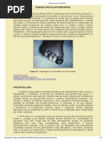 Doença Vascular Periférica