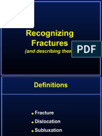 Recognizing Fractures