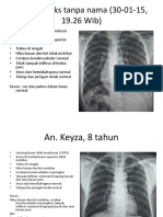 Toraks tanpa nama (30-01-15