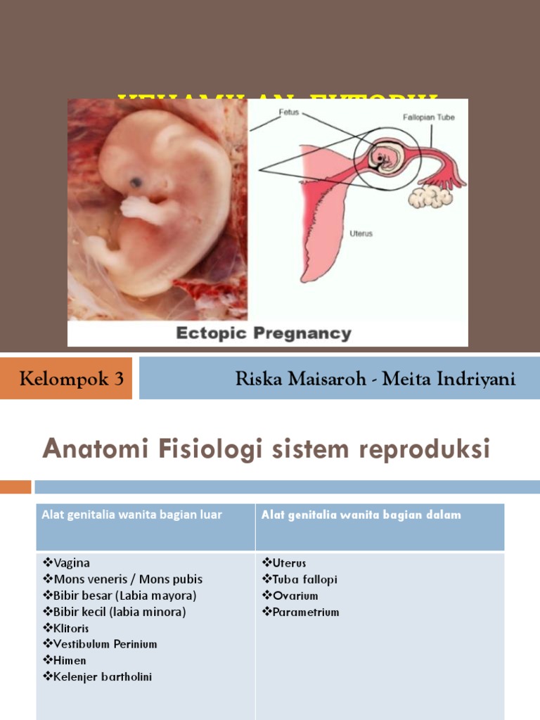 Kehamilan Ektopik Terganggu | PDF | Pengembangan Diri | Sains & Matematika